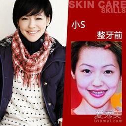 angelababy面部鉴定力证未整容女明星是整容还是整牙