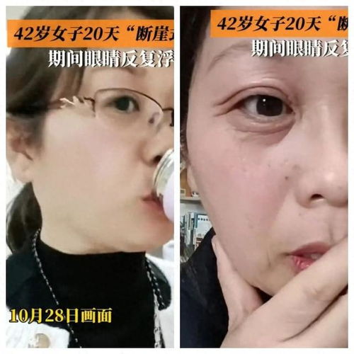 女子20天老了30多岁吓坏网友,如何减缓衰老