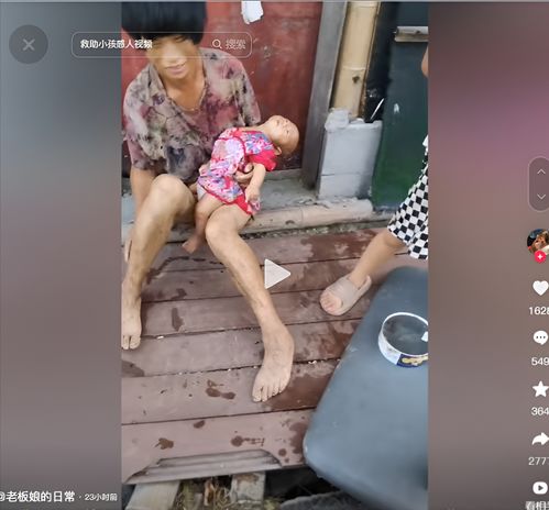 天崩开局3个月大的宝宝,靠白糖水充饥果腹,年仅3月,营养不良奶粉婴儿宝宝母乳白糖水营养不良手机网易网