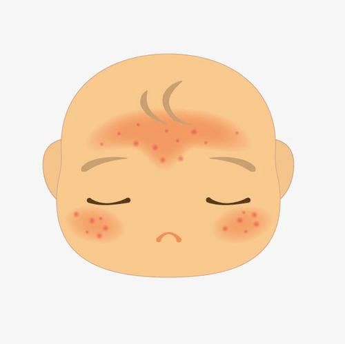 酷育儿冬季宝宝皮肤问题高发这几个问题没搞清,当心越护理越严重