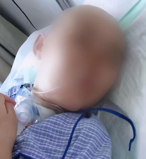 12岁女孩被继母打成植物人,孩子父亲肯定会上诉