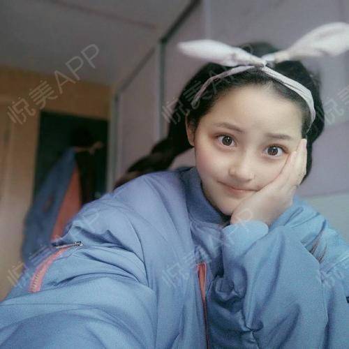 今天回老家,居然被村里人喊我,小姑娘,我看起来有这...鼻综合悦美整形