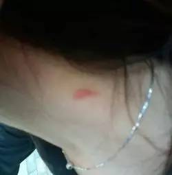 女生头像脖子种草莓