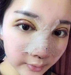 62岁老太整成赵雅芝,19岁女孩整成热巴,就服整成范冰冰的她