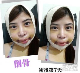26岁女生头像整容