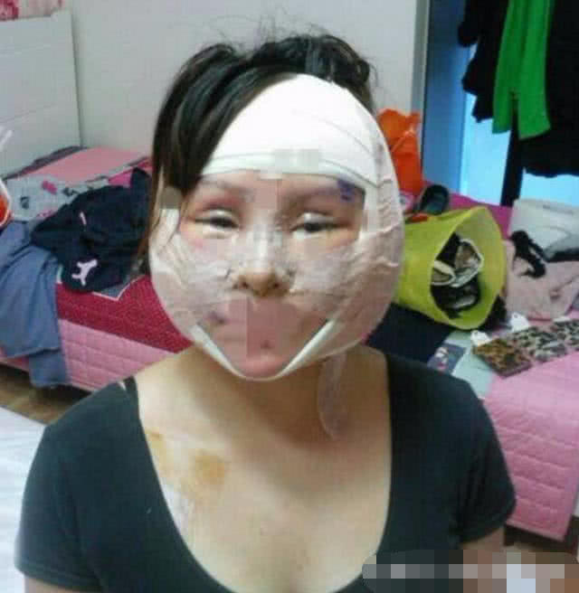 20岁女子花巨款整容200多次,只因男友嫌她丑,看着让人害怕