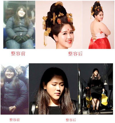 减出我人生200斤女胖子整容真人现身