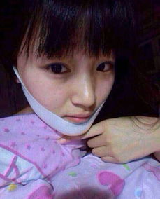 我是女生,脸好胖,怎么样可以瘦脸呢