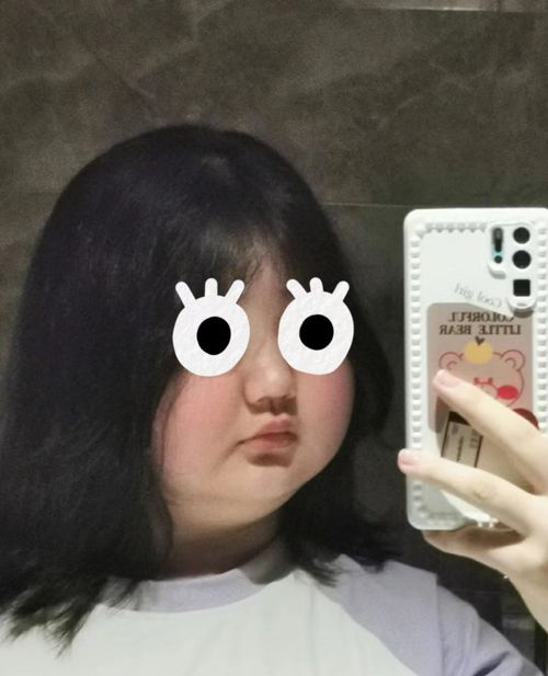 15岁少女乐观记录3年罕见病生活打动网友我是一个罕见的少女