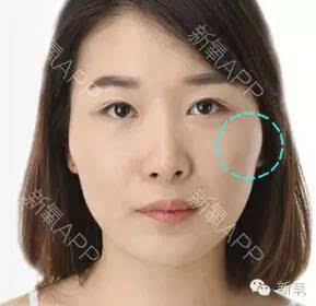 科普从大脸盘逆袭成小v脸的女明星,她们才不是一刀切