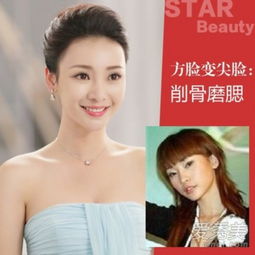 沈梦辰柳岩杨乐乐李思思当红美女主播整容了吗