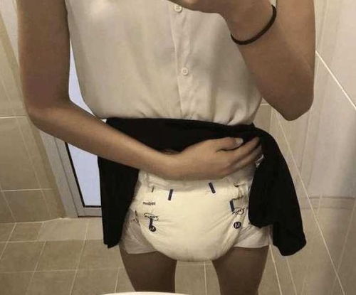 女子穿尿不湿拍照发朋友圈,终生离不开纸尿裤,背后真相让人心痛
