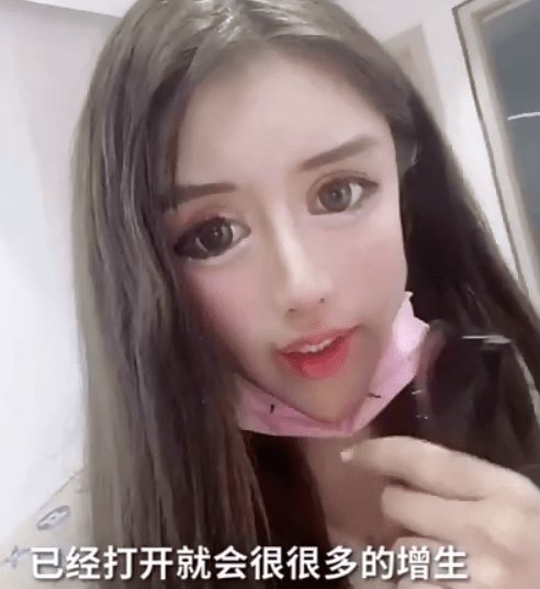 13岁就开始整容的女网红出现后遗症医生称嘴巴缝太多无法修复