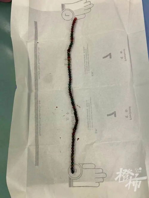 4岁女孩误吞61磁力珠,引发14处肠穿孔家长注意,这种玩具别再给孩子买了