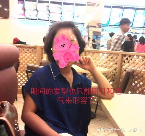 关于20多岁的女生没有头发要戴一辈子假发