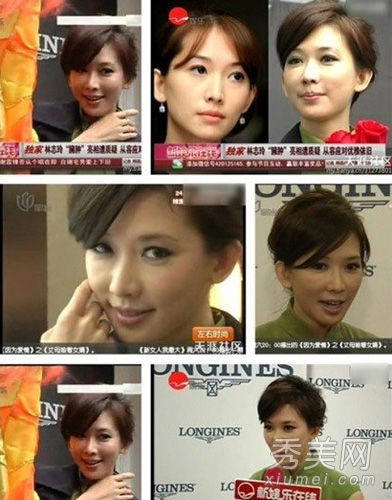 林志玲大s领衔女星整容后遗症变塑胶脸