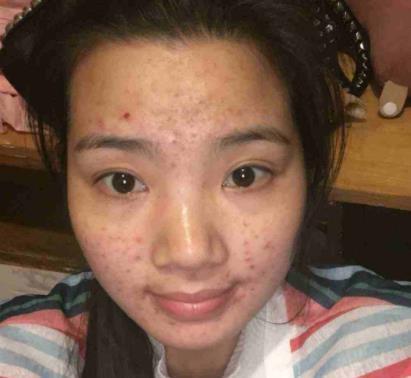 长期化妆的女生,迟早会面临这3个苦果,小仙女不妨了解